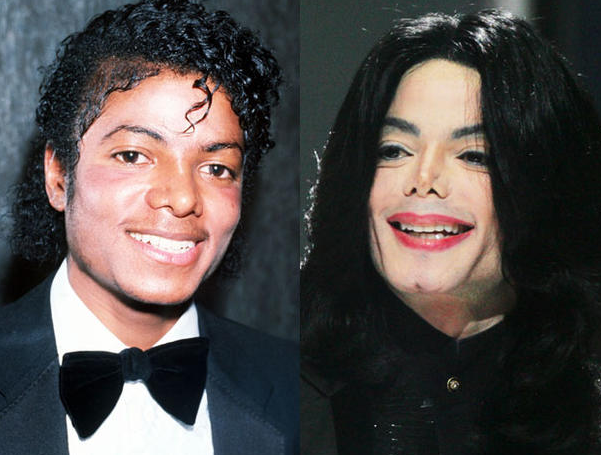 Michael Jackson, Before and After Plastic Surgery