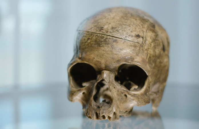 Nat Turner's Skull